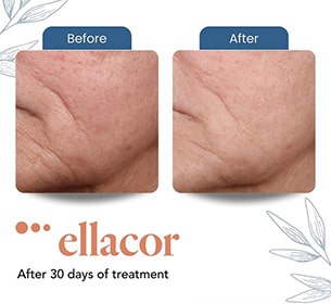 ellascor